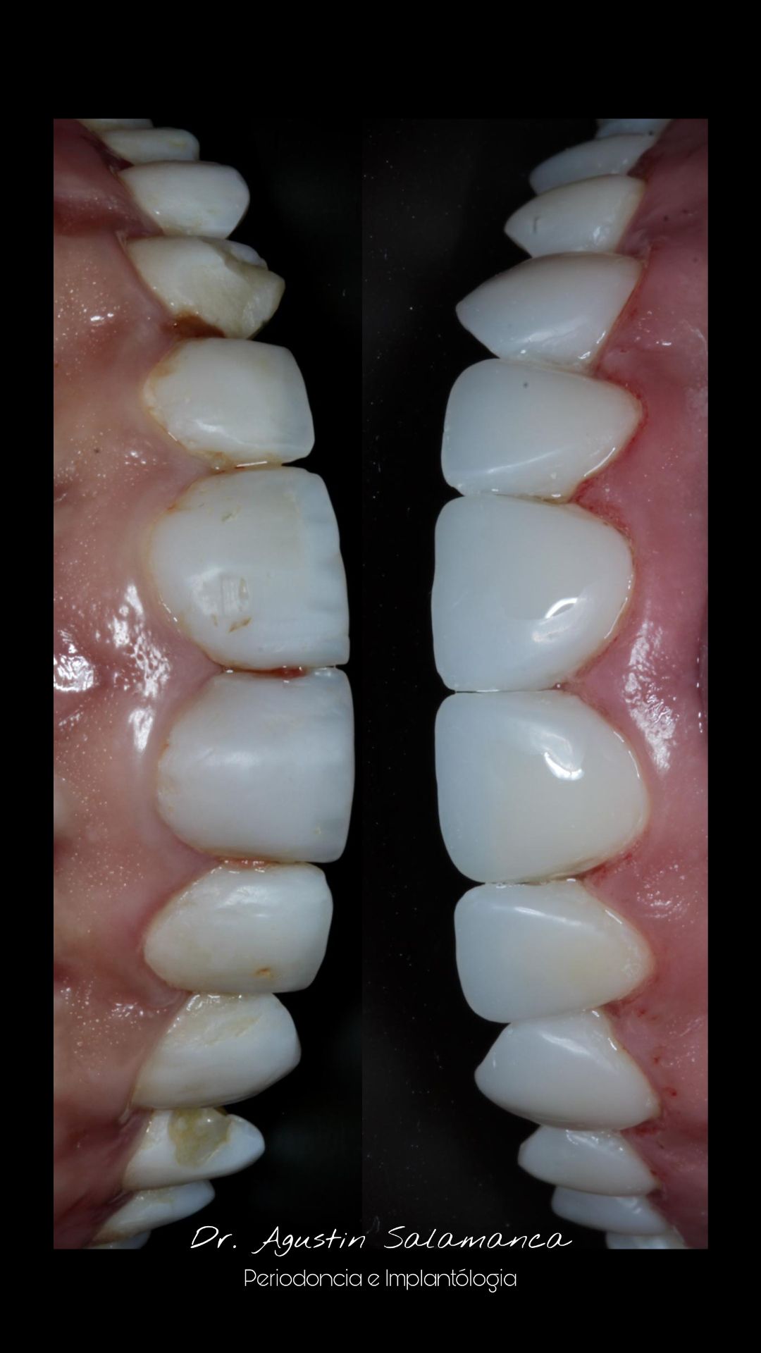 Agustin Salamanca Tapia-21