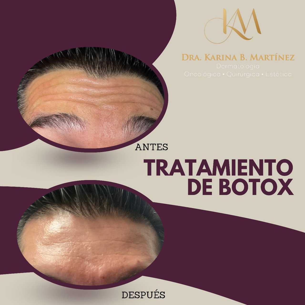 Karina Martinez Chavarria-8