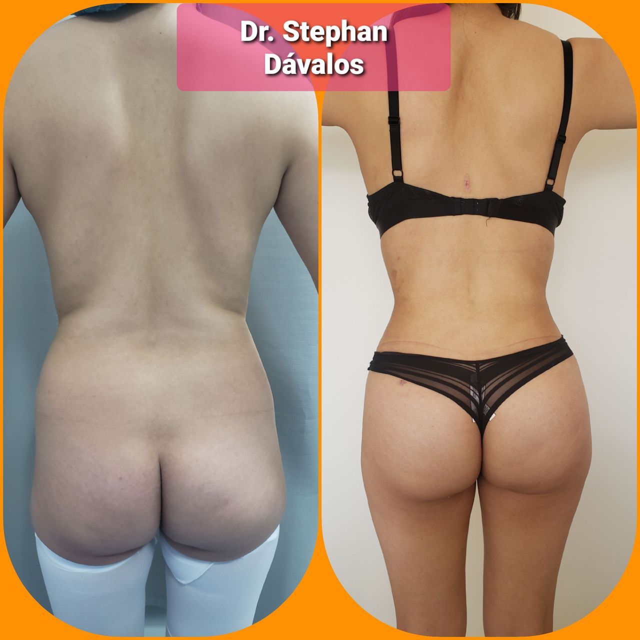 Stephan Dávalos Barrios-7