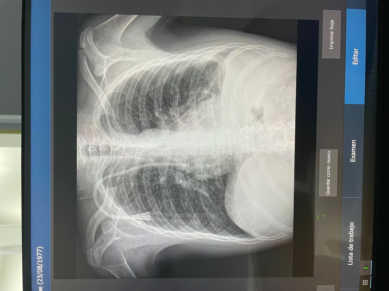 Carlos Andrés Carmona Bautista-3