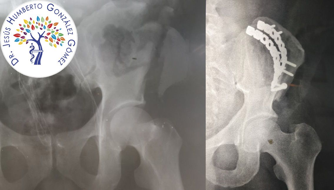 Jesús Humberto González Gómez-11