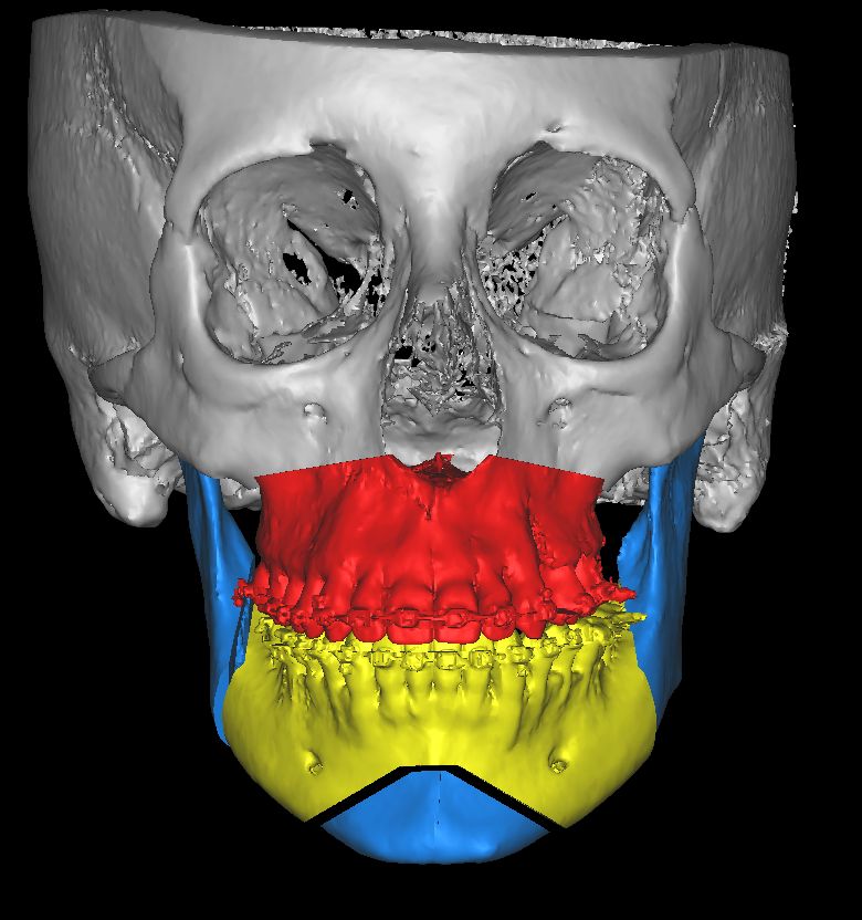 Christian San Juan González-5