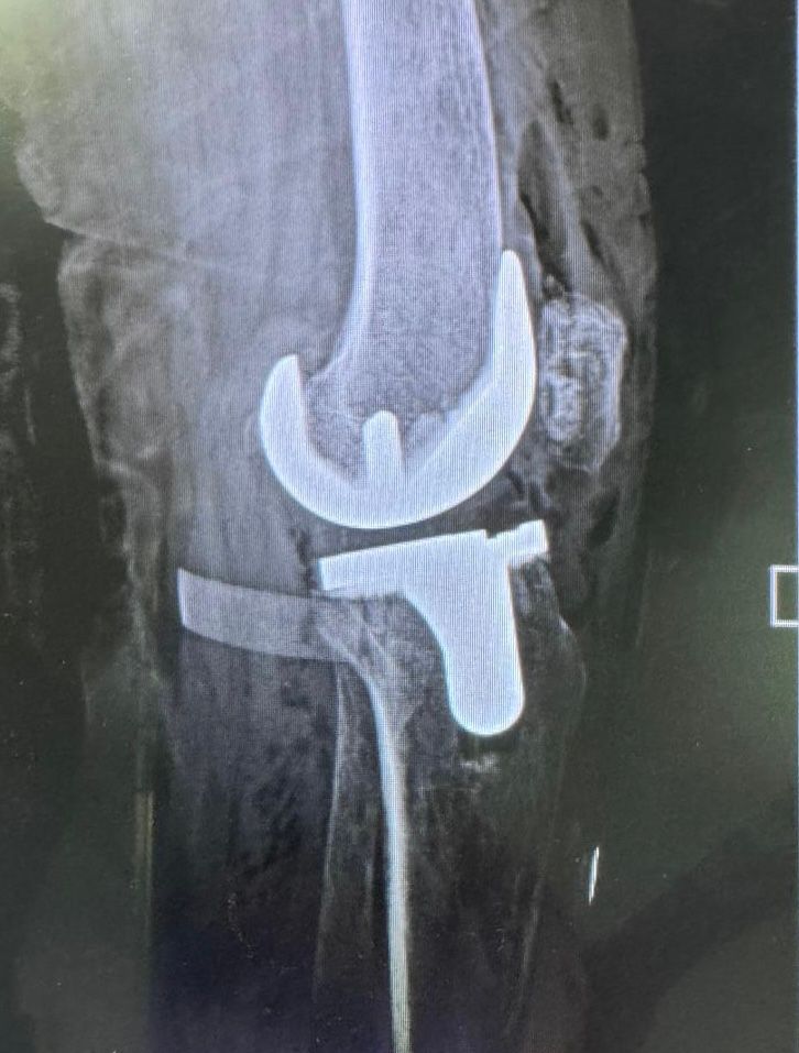 Monica Álvarez Cedeño-3