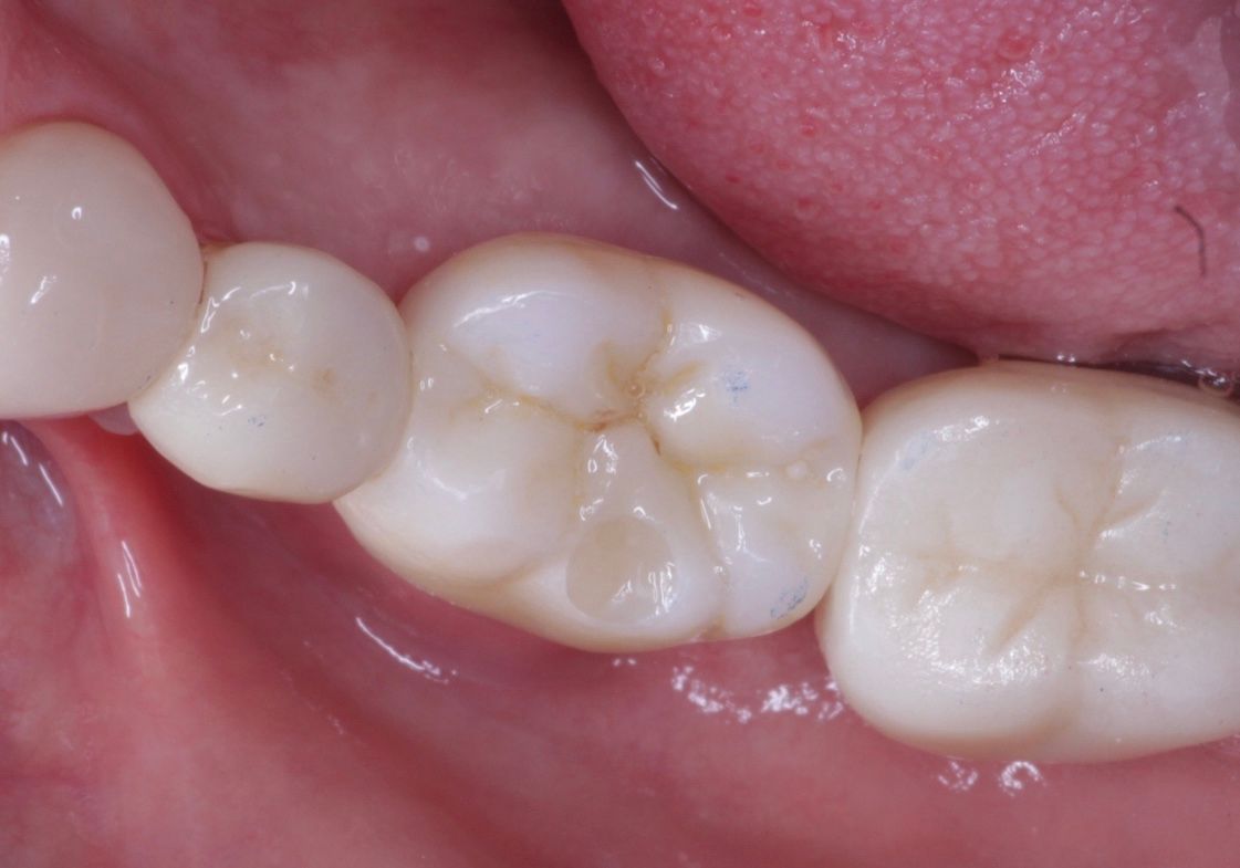 Josué Márquez Gómez-79