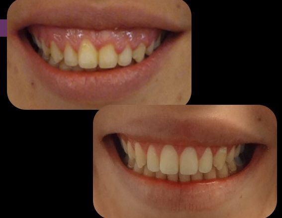 Erika Díaz De León Torres-11