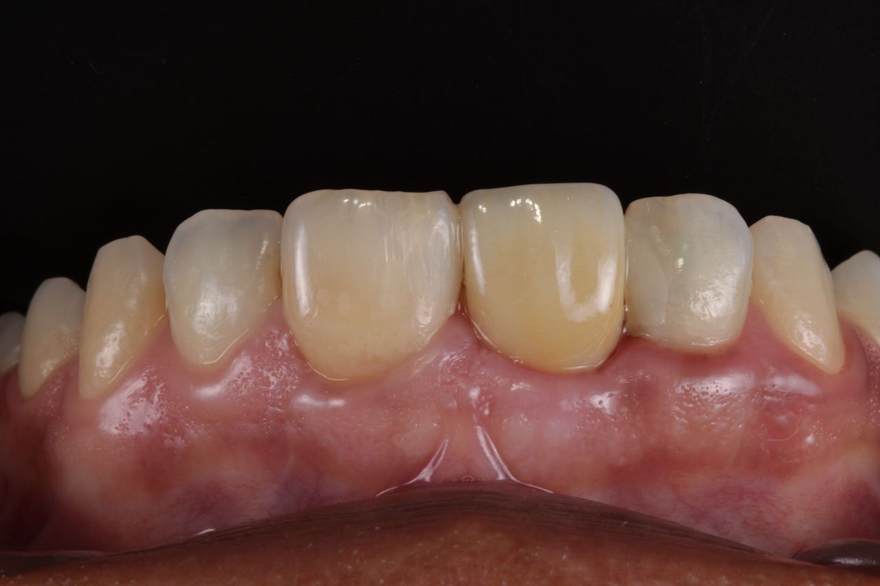 Fernando Fuentes Lozada-4