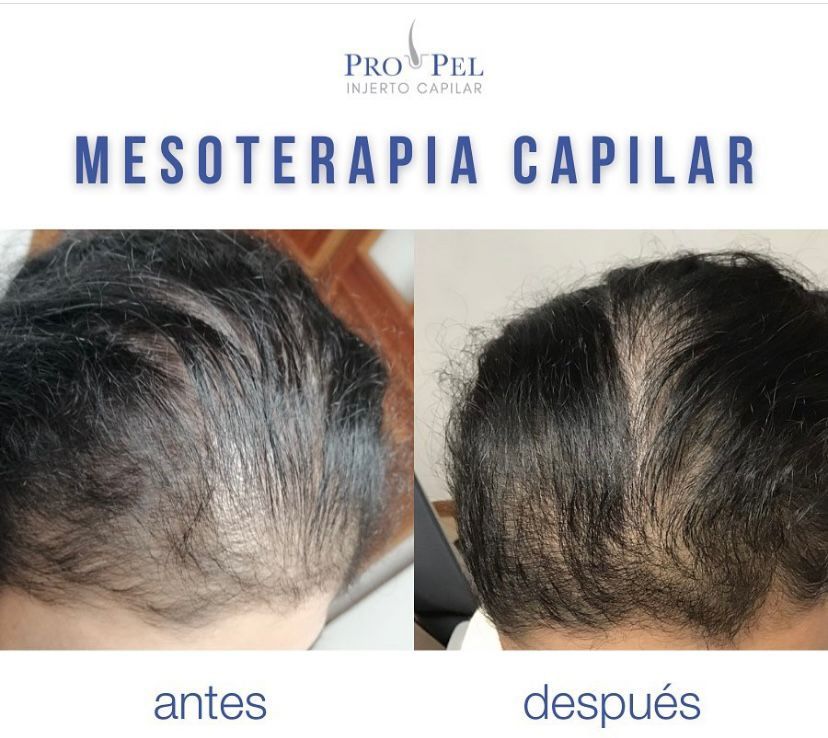 Karla Vanessa Becerra-25