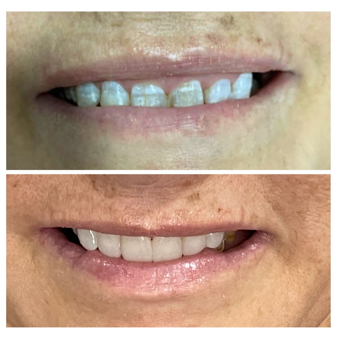 Janeth Arzate Banda-7