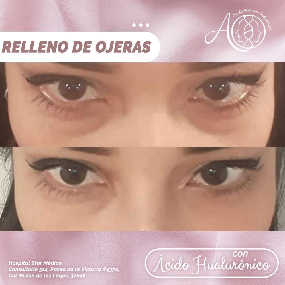 Xochitl Andrea Avalos Alvarez-7