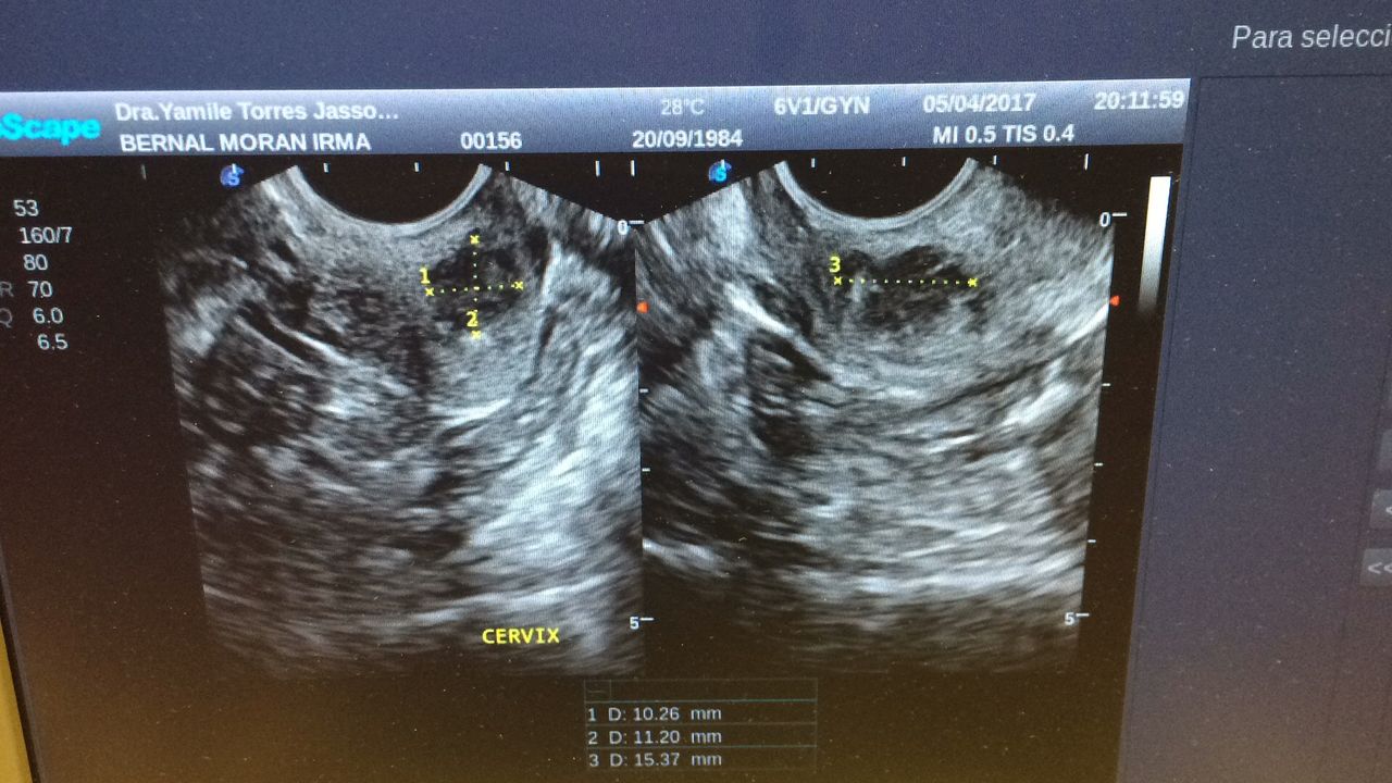 Yamile Torres Jasso-8