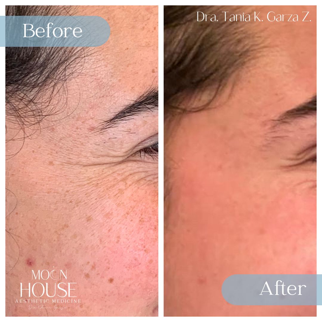 Tania Karine Garza Zepeda-23