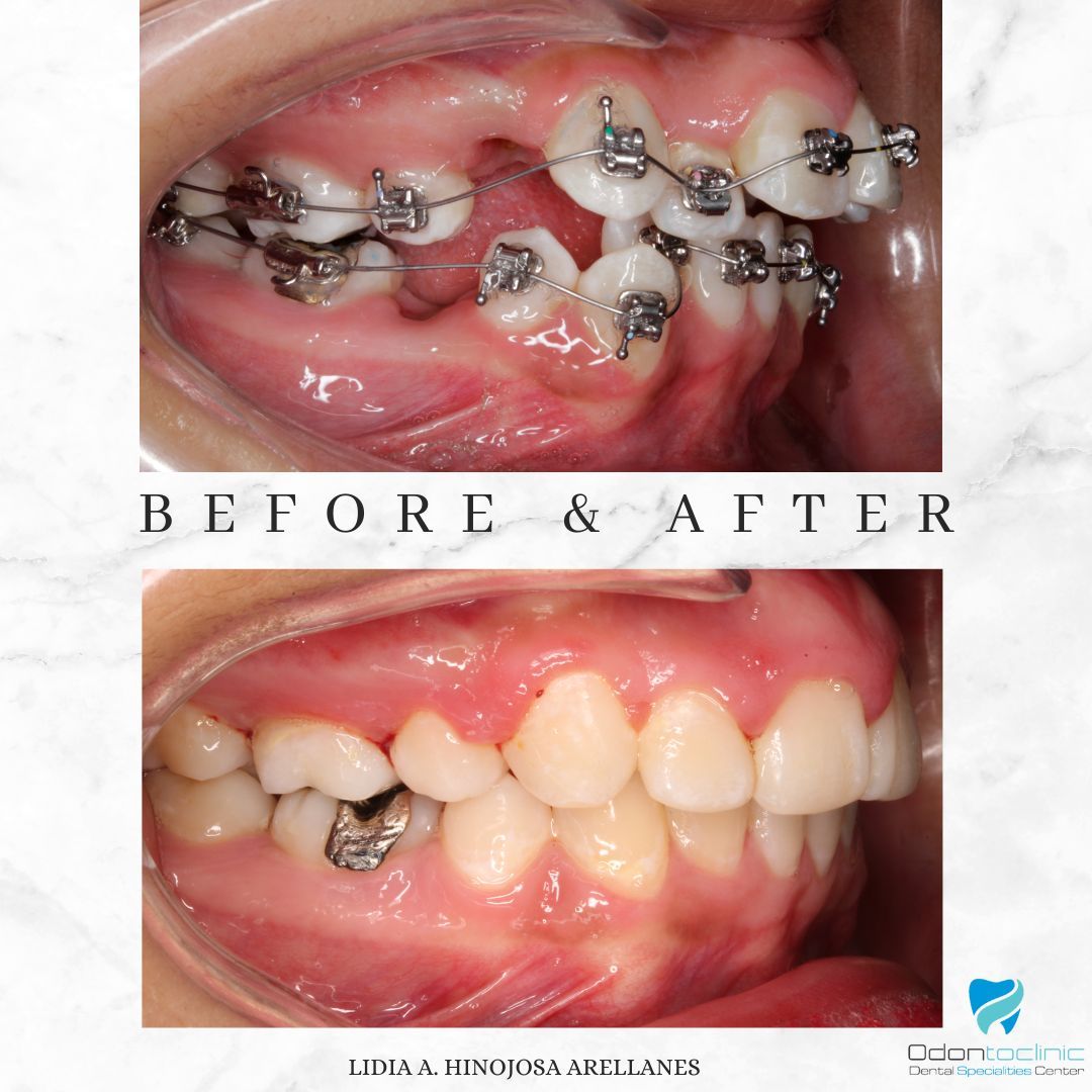 Lidia Abigail Hinojosa Arellanes-13