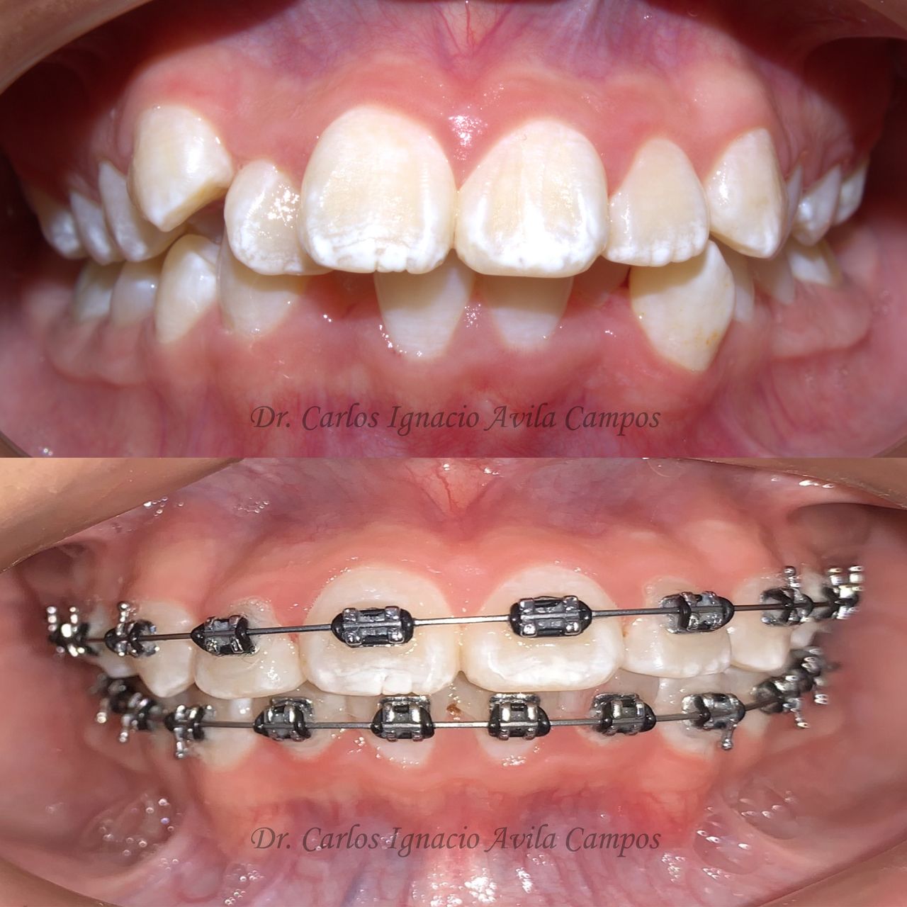 Carlos Ignacio Avila Campos-16