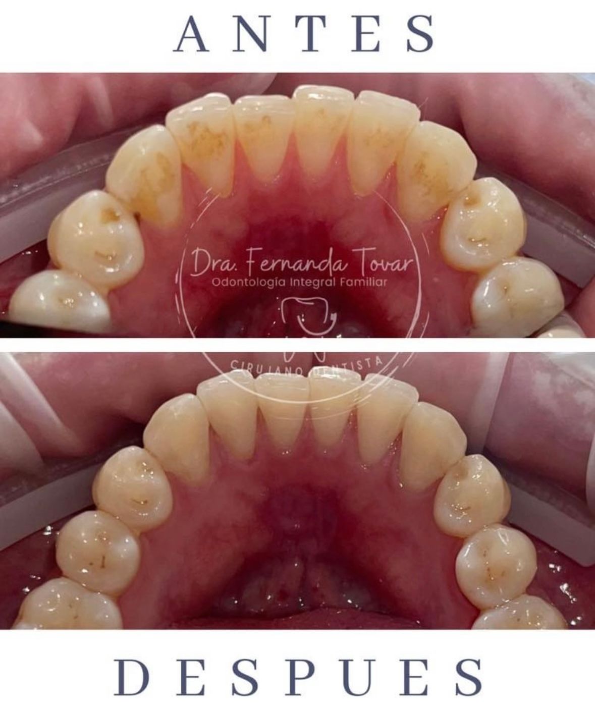 Fernanda Tovar Navarro-7