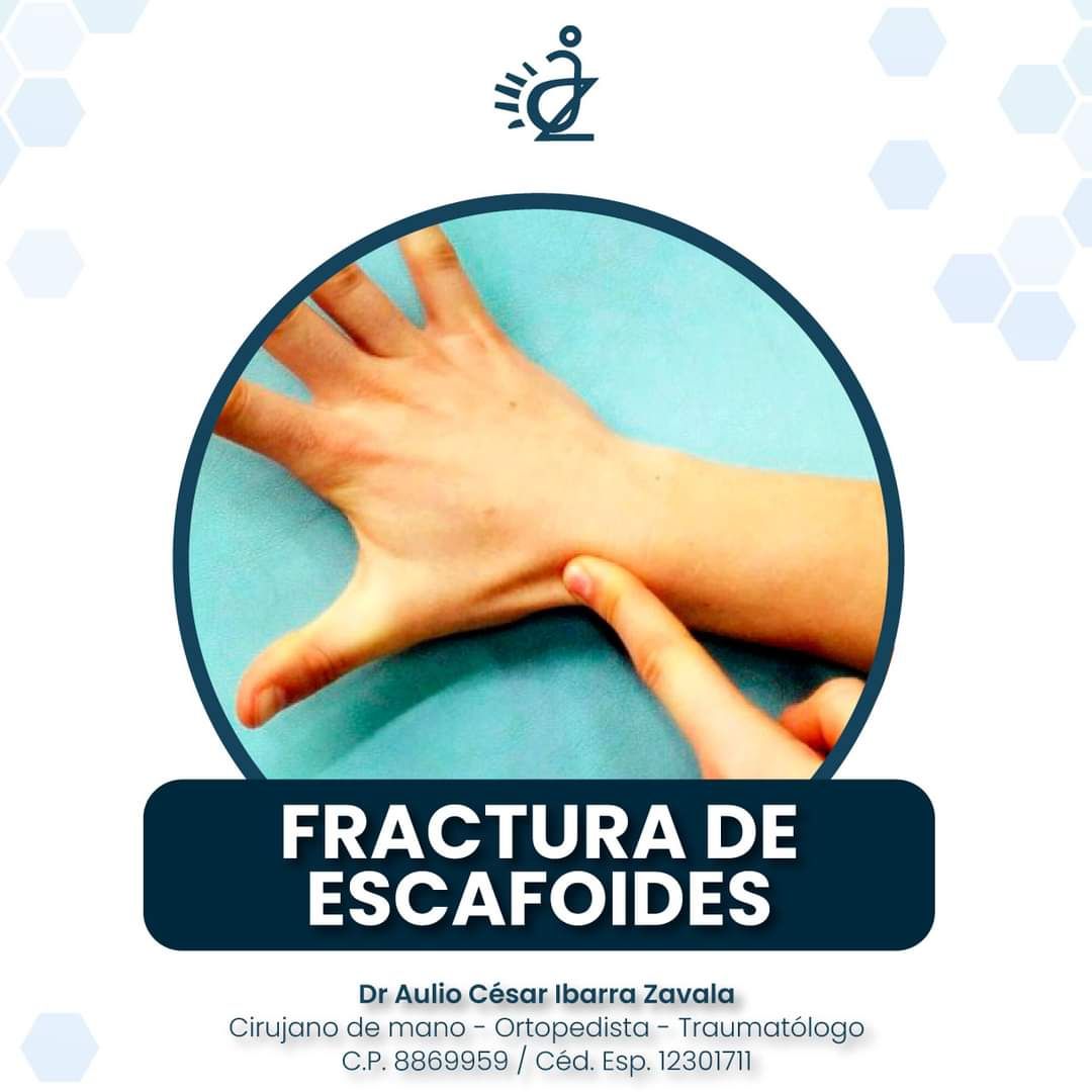 Aulio Cesar Ibarra Zavala-7