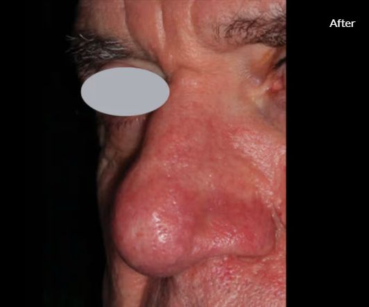 Jorge Luis Villalobos Ibarra-9