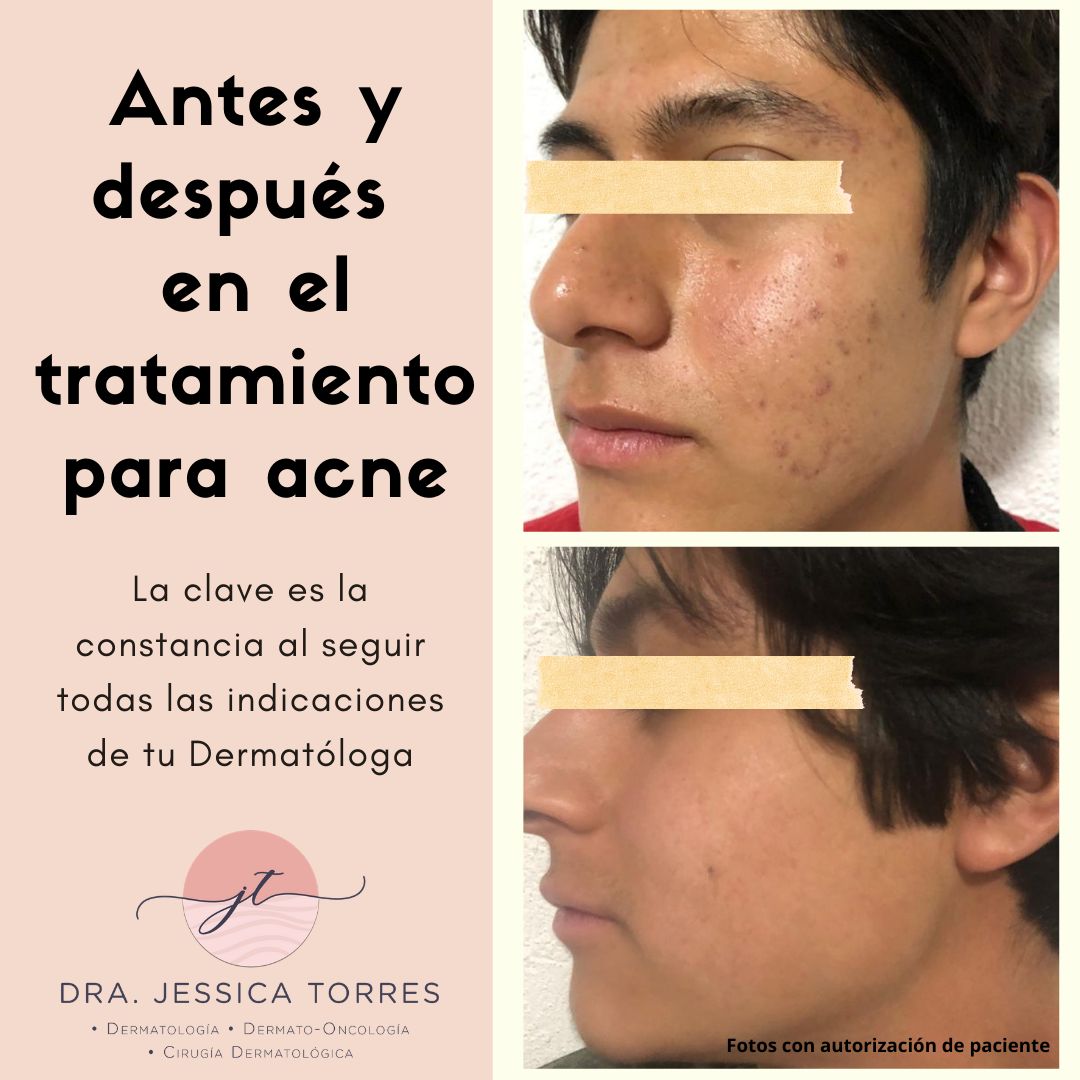 Jessica Torres Haro-3