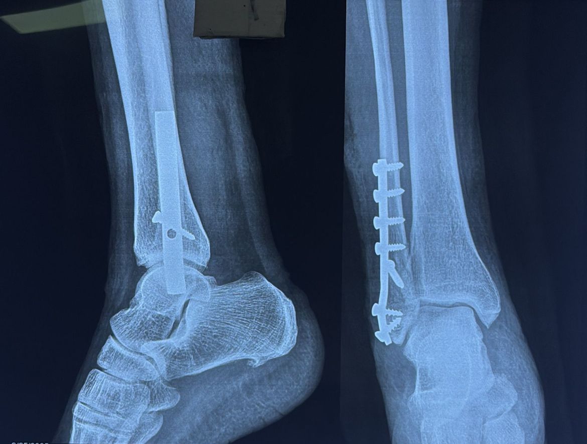 Cristian Ernesto Murillo Medina-20