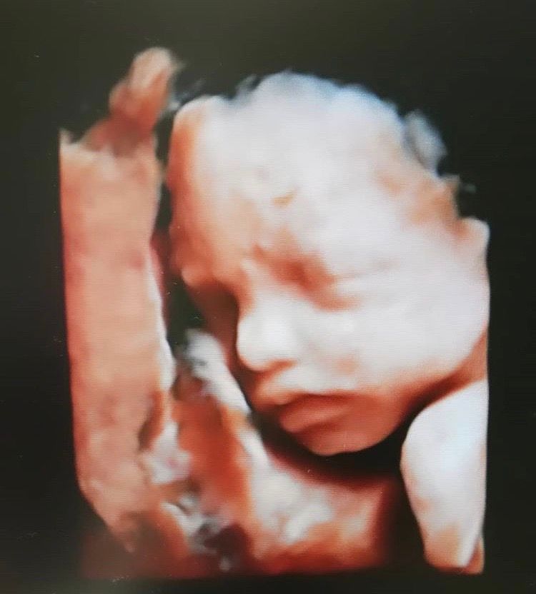 Doris María Castillo Gutiérrez-12