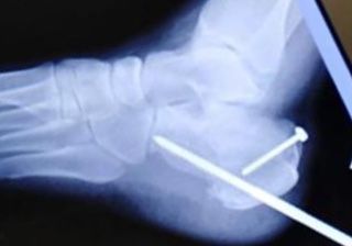 Gerardo Bautista Díaz-14