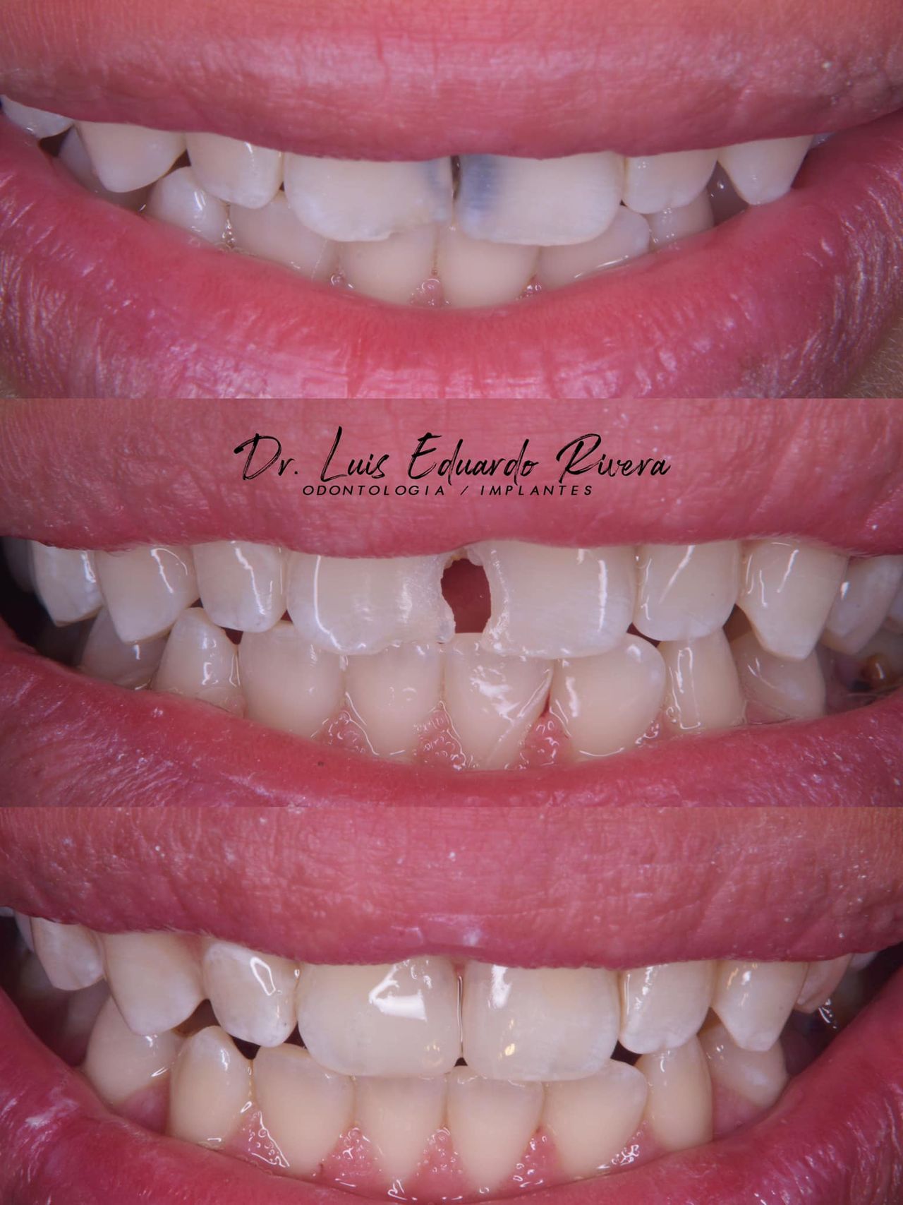 Luis Eduardo Rivera-59