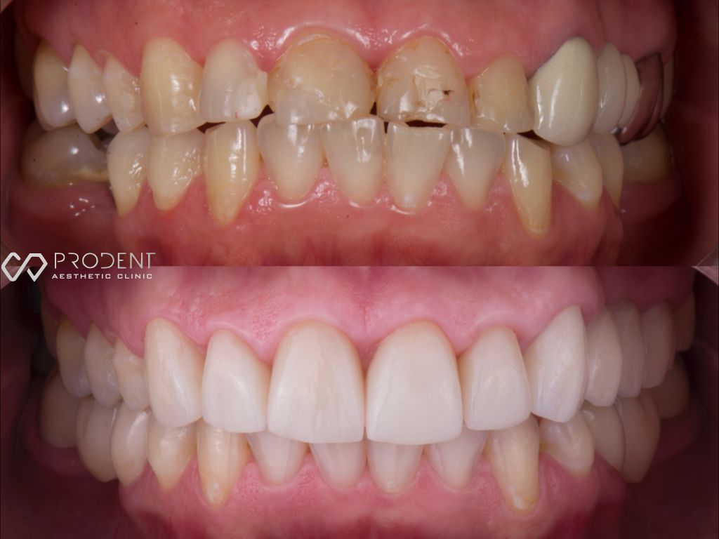 Ulises Pérez Murillo-46