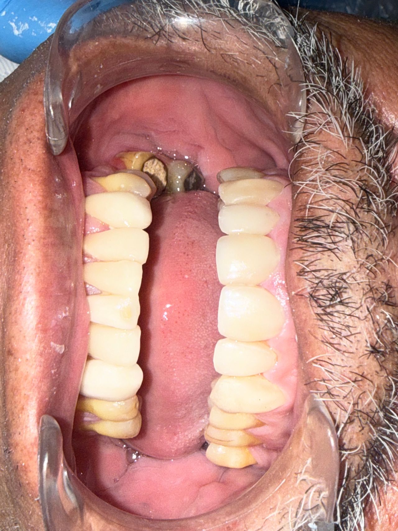 Eduardo López Méndez-8