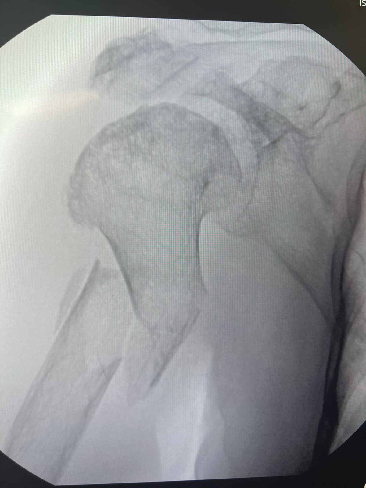 Oscar Alberto Pérez Peralta-28