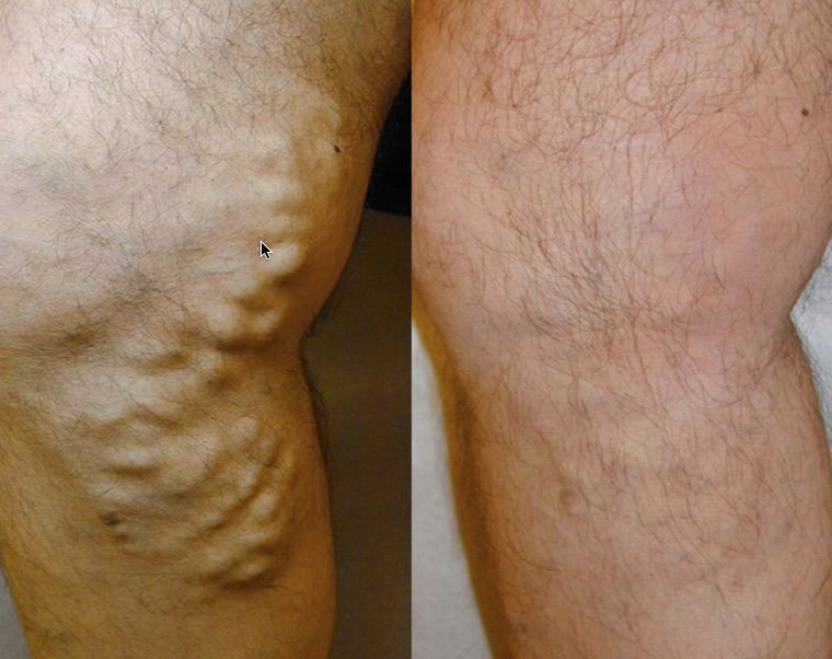 Alejandro Ayón Guzmán-6