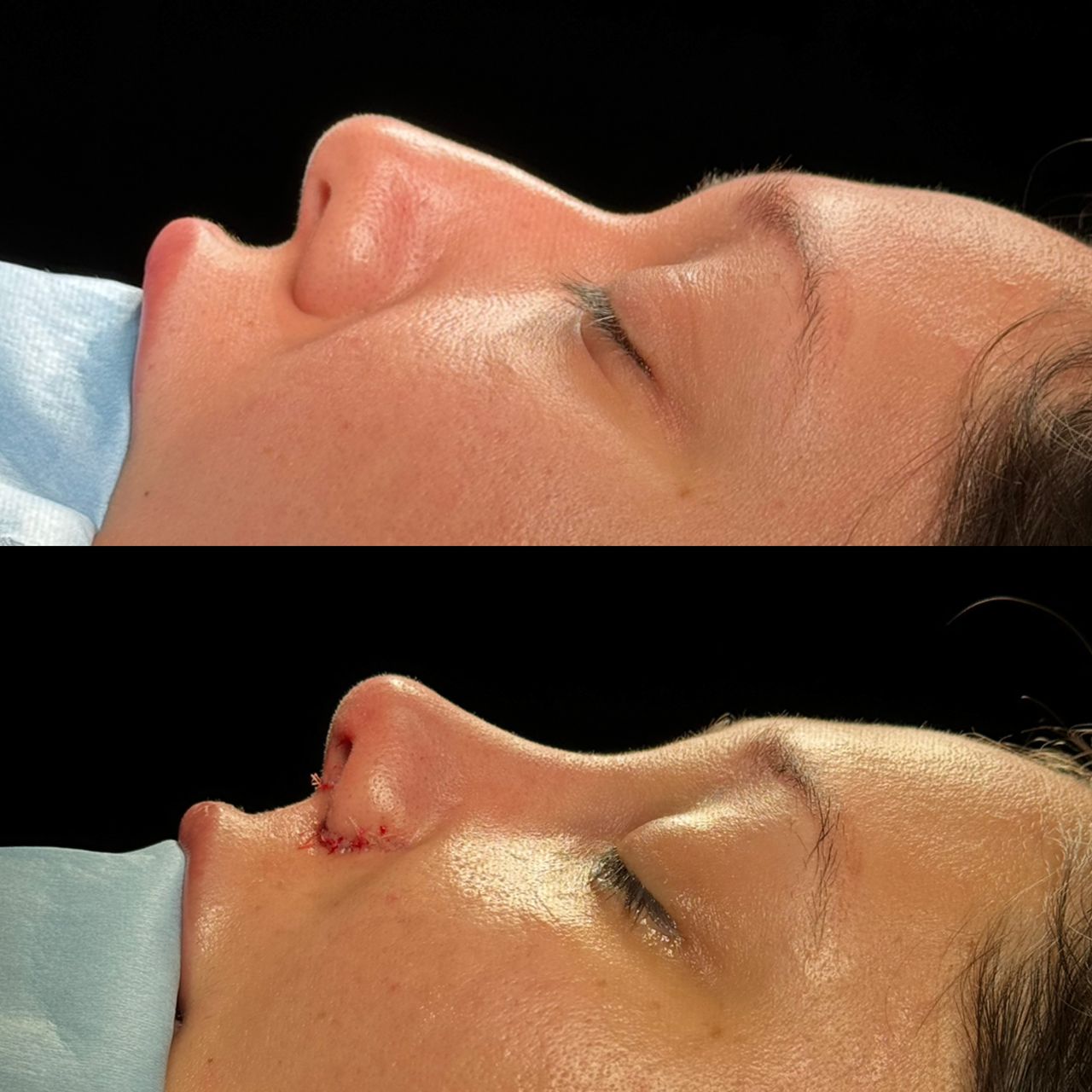 Angel Castro Urquizo-91