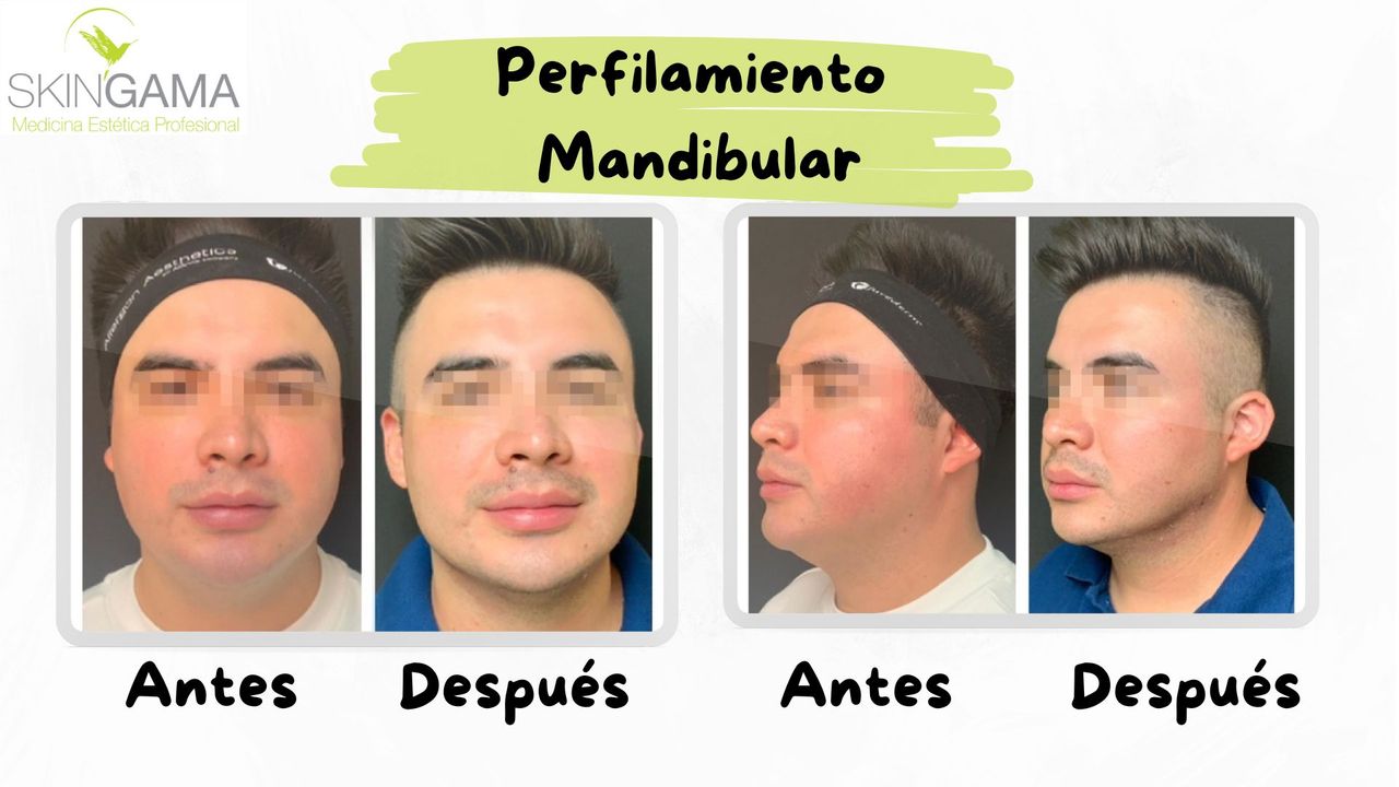 Juan Herrera Hernández-51