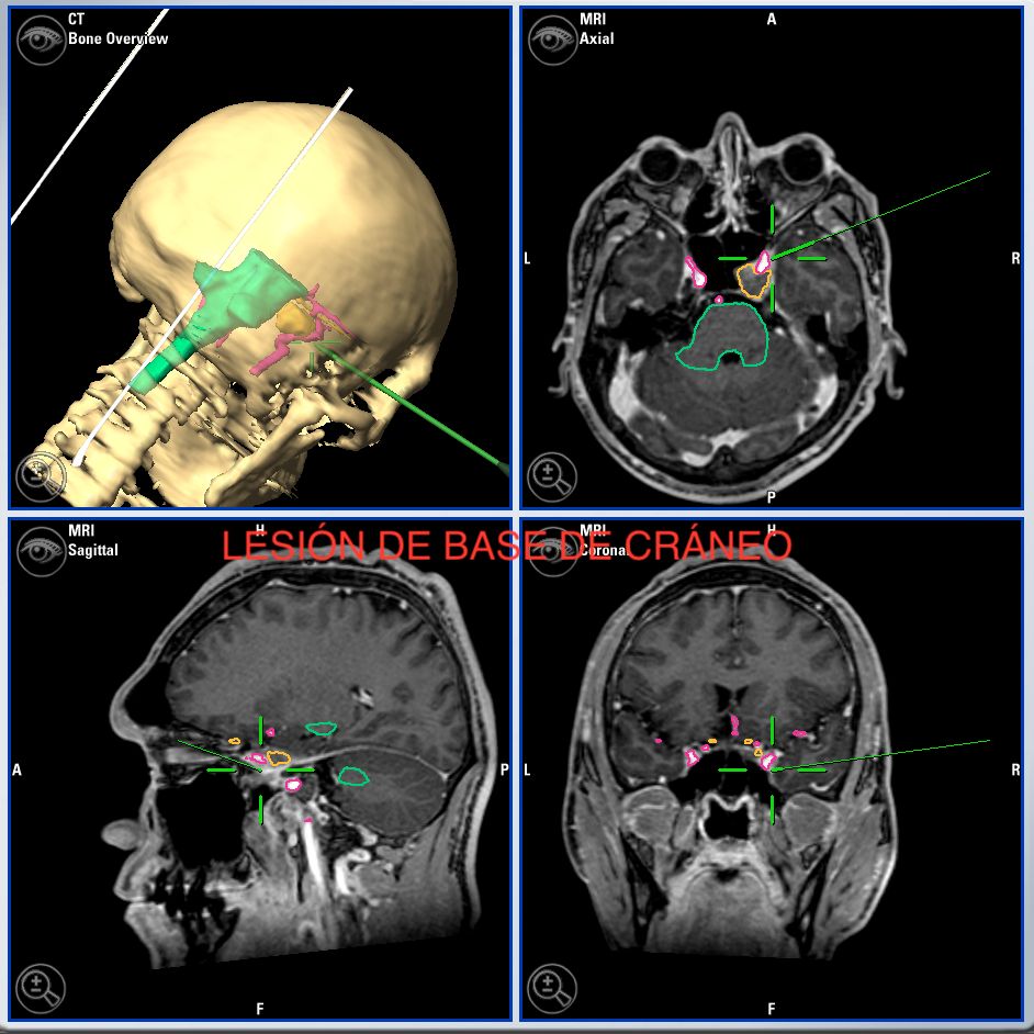 Enrique De Obieta Cruz-36