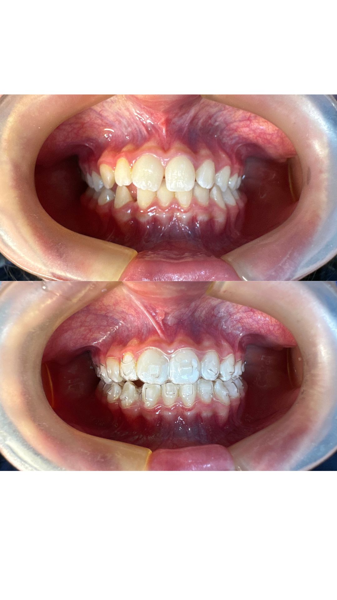 Heidi Mendoza Malagón-26