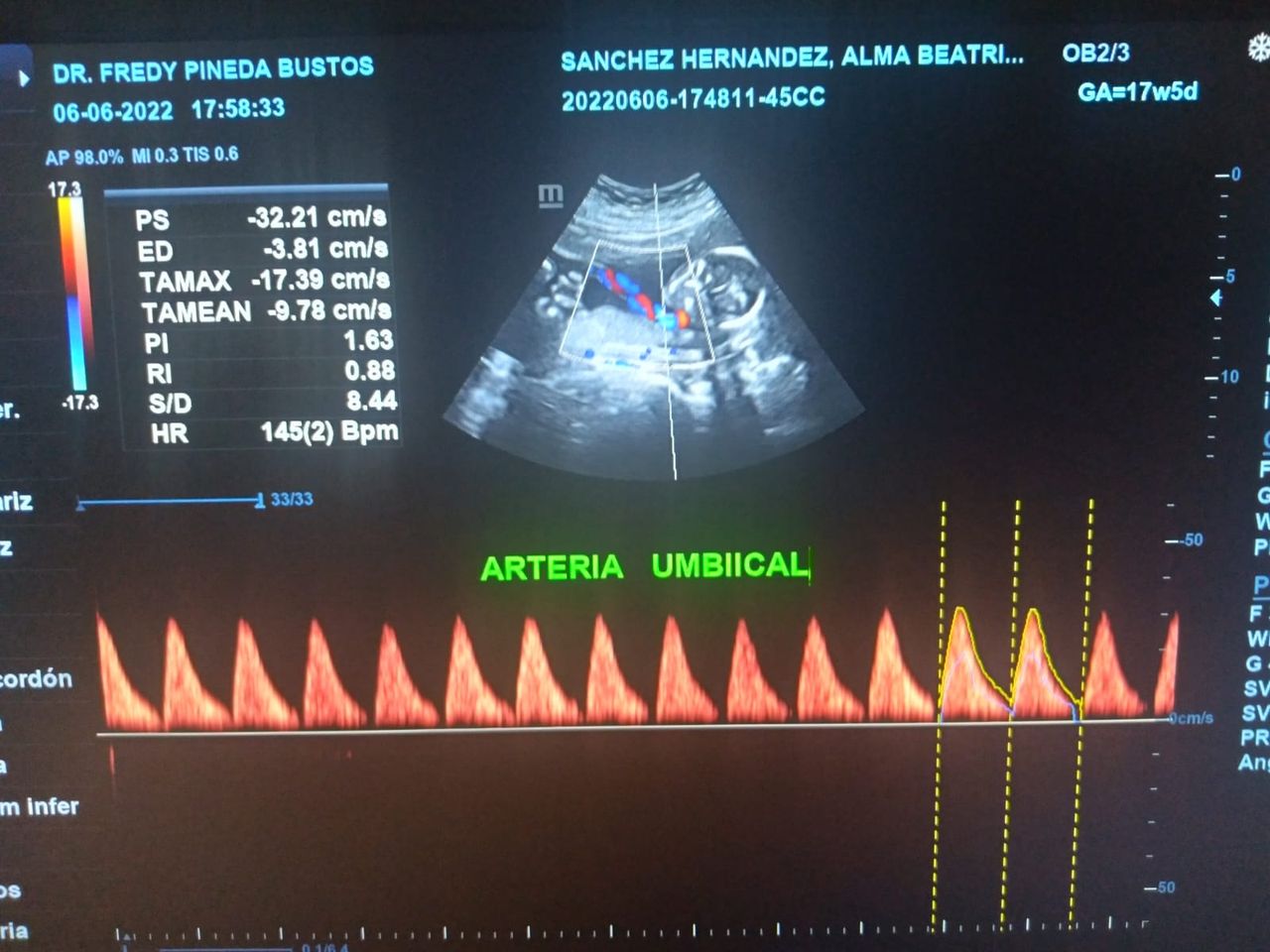 Fredy Pineda Bustos-1