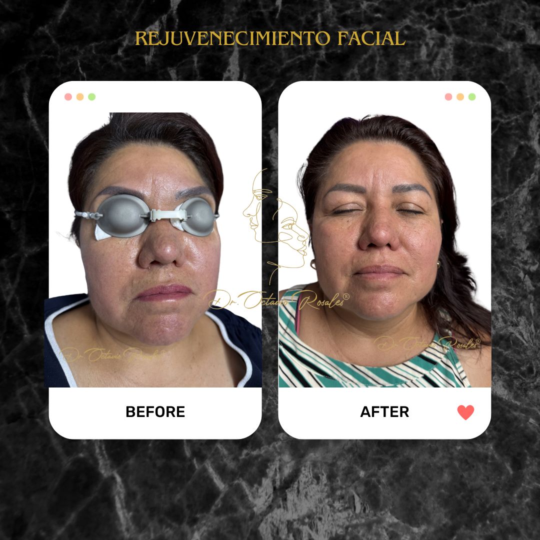 Edgar Octavio Rosales Diaz-11