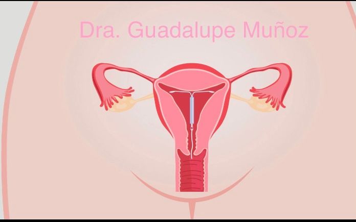 Guadalupe Muñoz Castro-105