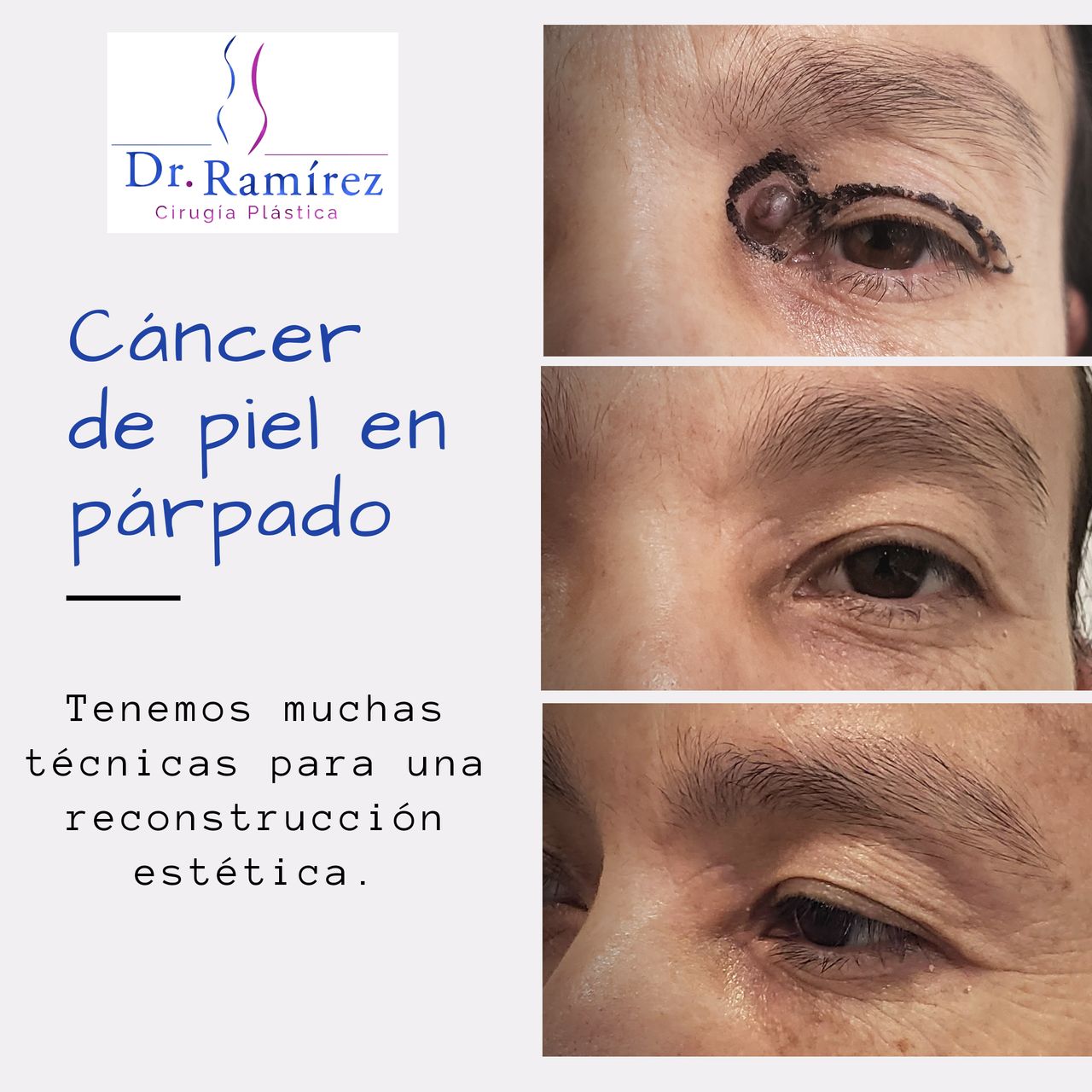 Edgar Ramírez López-111