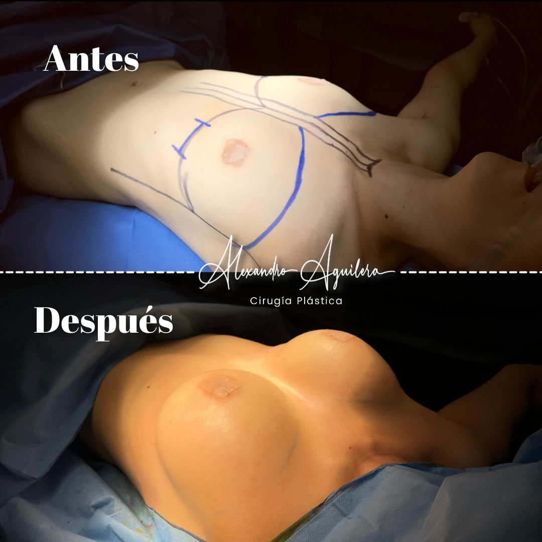 Alexandro Aguilera Salgado-22