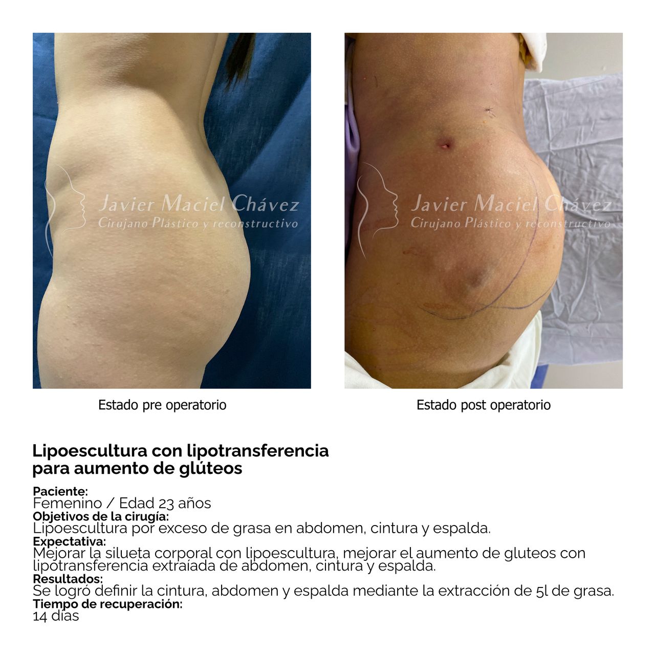 Javier Maciel Chávez-29