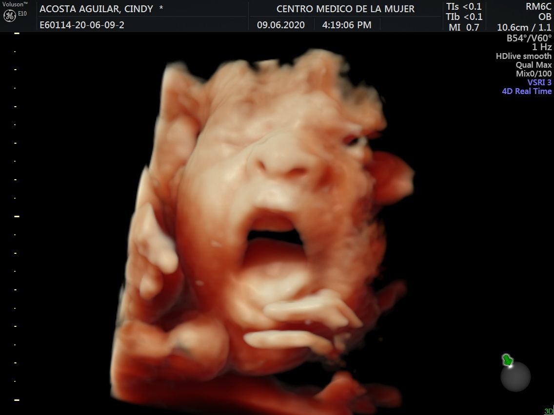 Julio Cesar Monárrez Martín-27