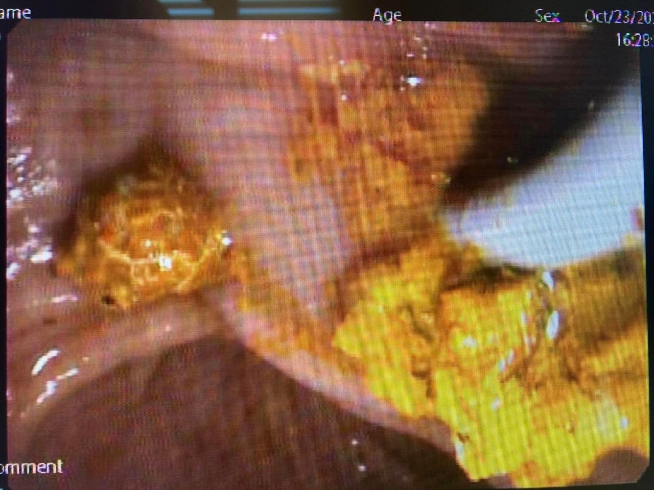 J. César Reyes Vásquez-8