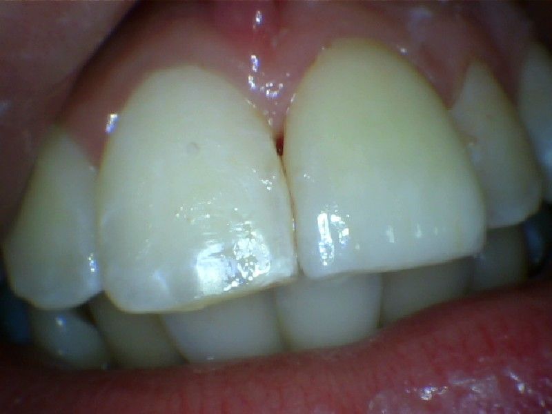 Jose David Torres Hernandez-18