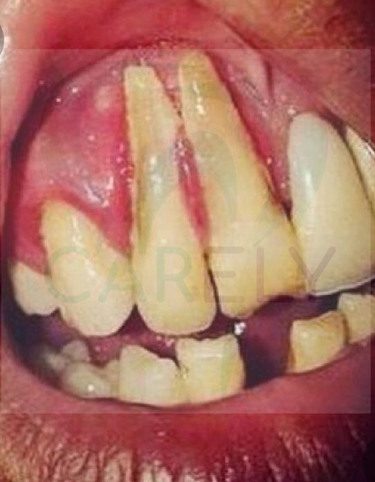 Carlos Candelaria Margarito-5