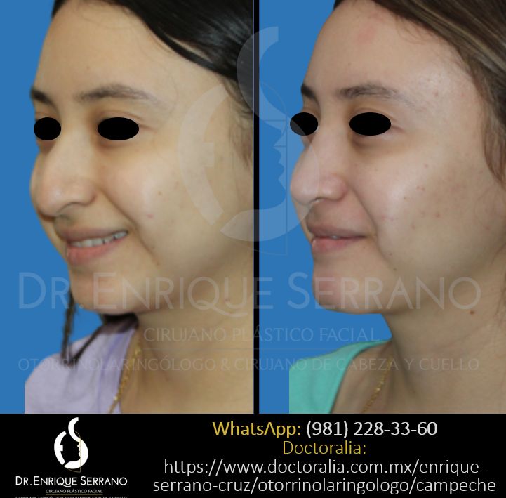 Enrique Serrano Cruz-52