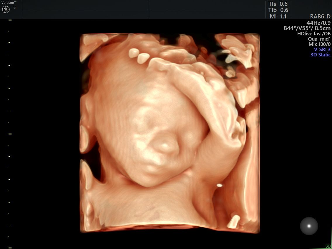 Gila Lili Barrientos Chavez-4