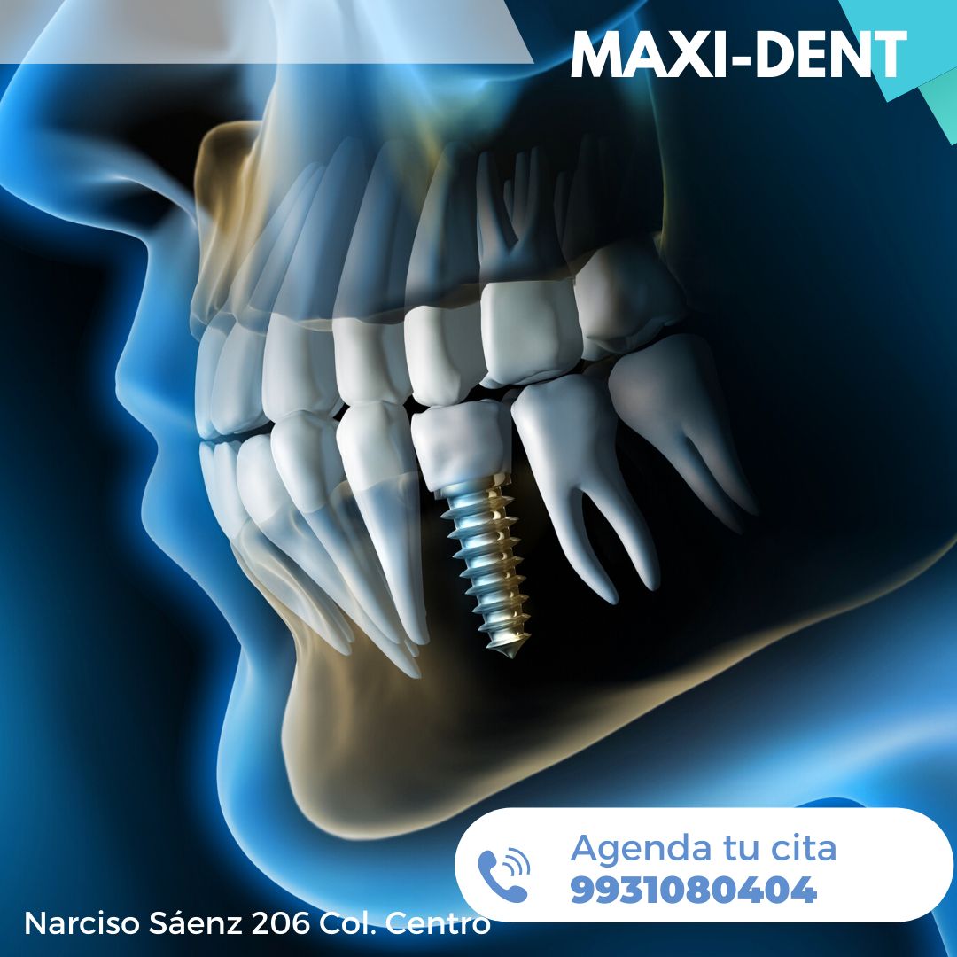 Jose David Torres Hernandez-17