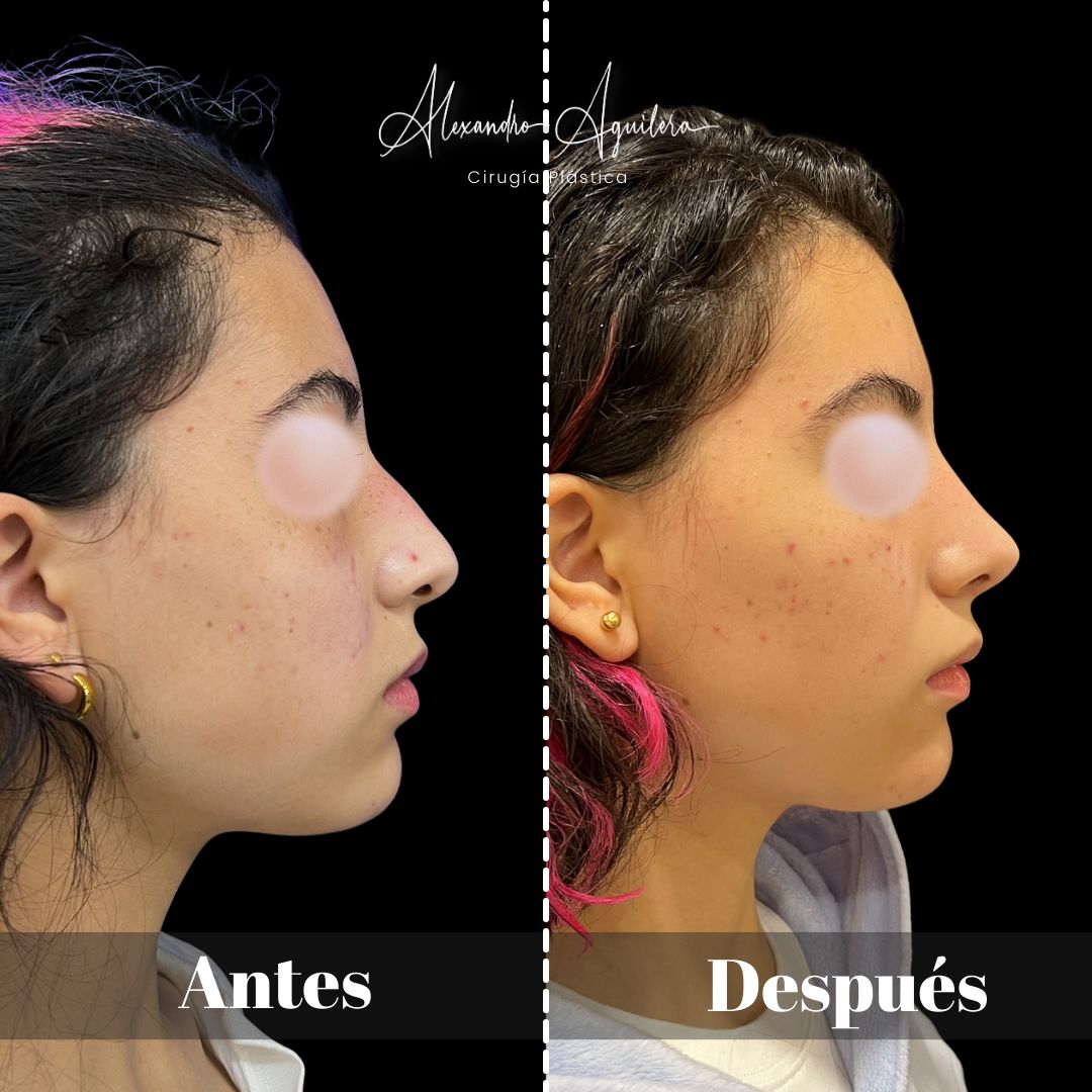 Alexandro Aguilera Salgado-37