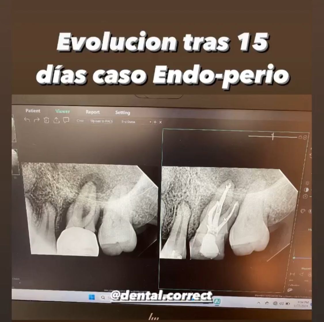 Aide Montserrat Orozco Gutierrez-48