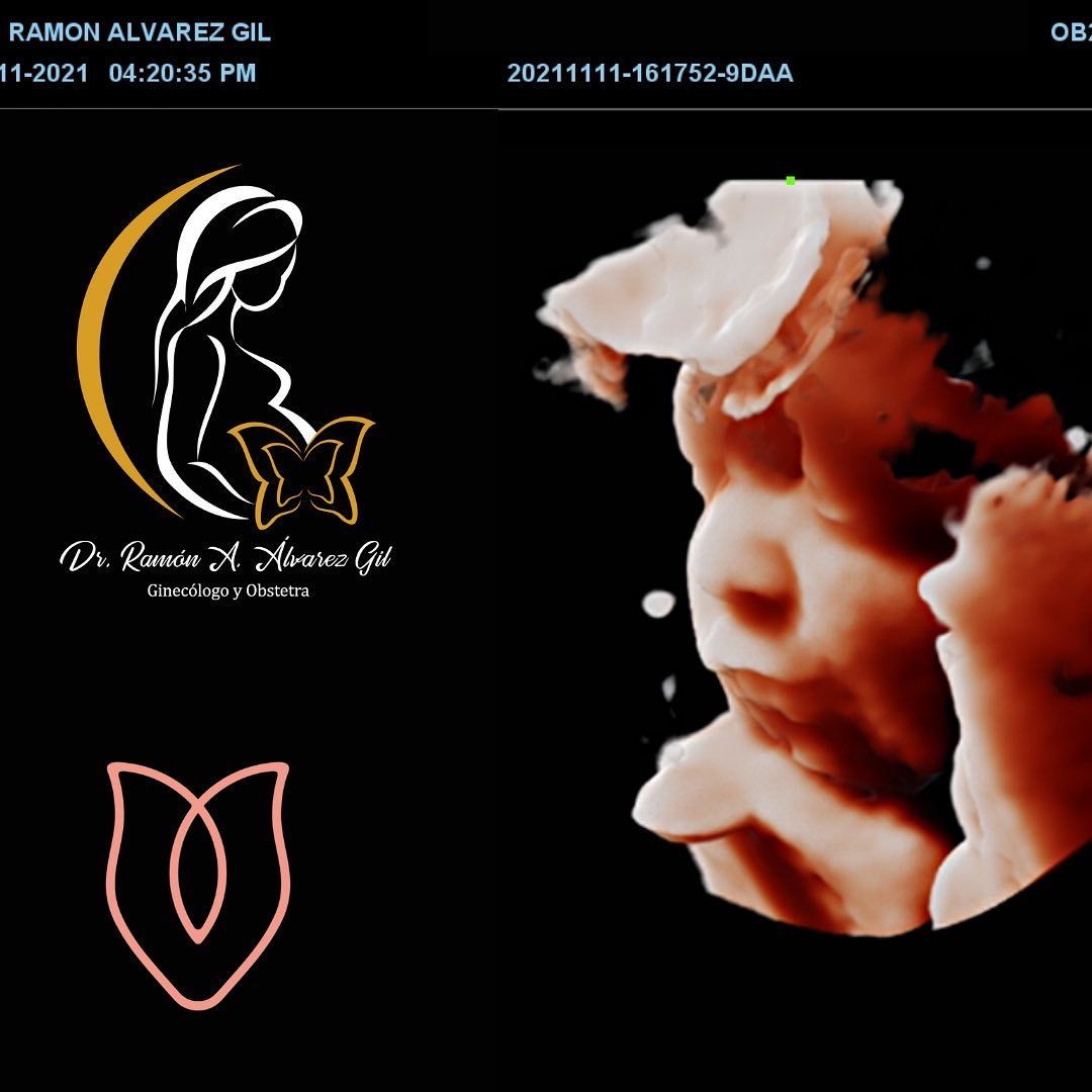 Ramón Antonio Alvarez Gil-5