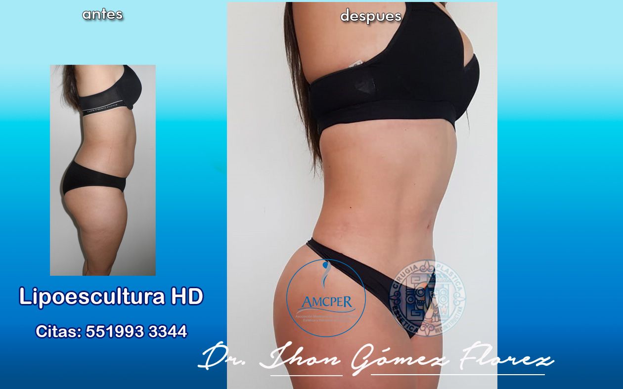 Jhon César Gómez Florez-47